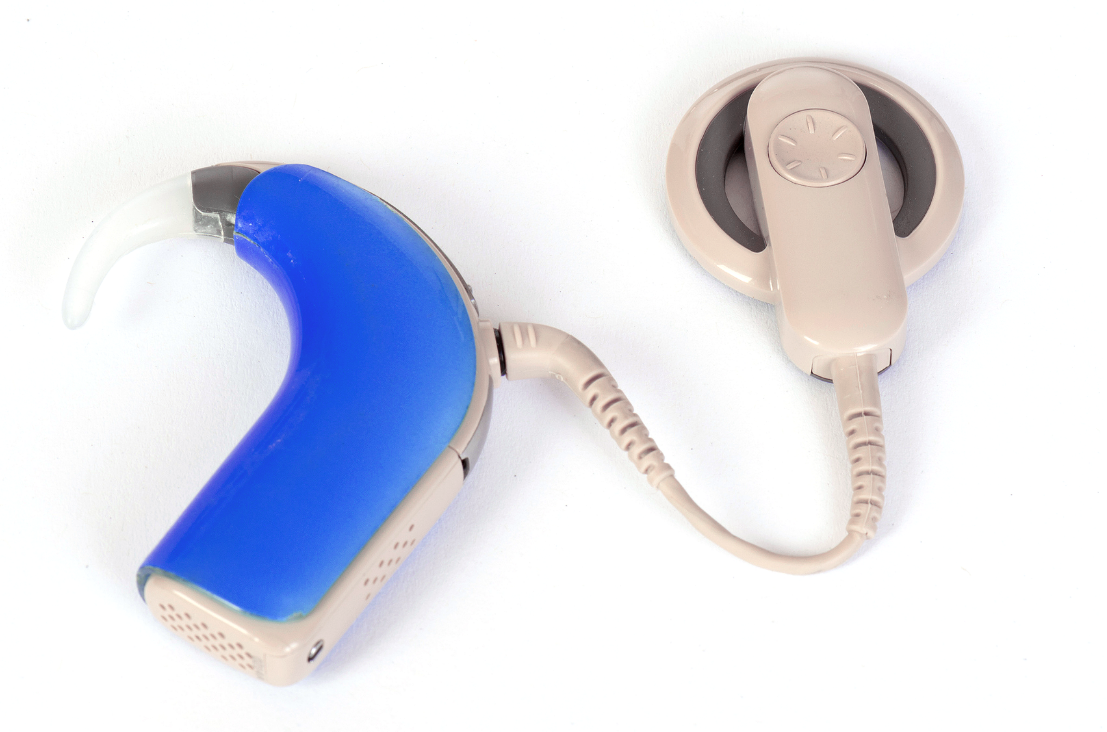 Cochlear Implant Electronics