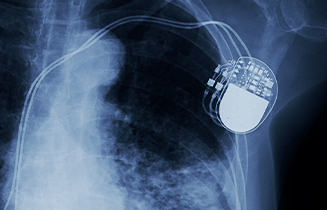 Medical Imaging of a Pacemaker in a Patient