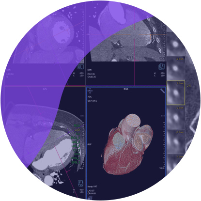 Leadless Pacemaker Betavoltaic Power Source